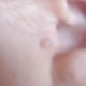 Micro labret Biosafe 1.2mm pour éléments à visser