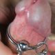 Anneau de gland ou de verge avec boule